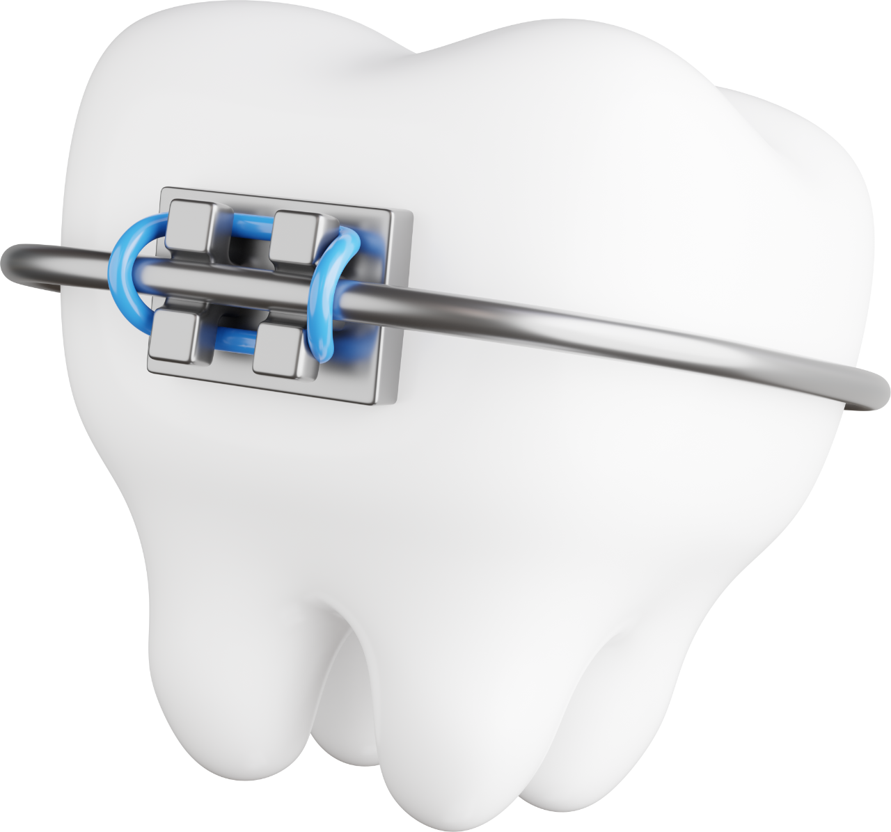 bagues orthodontie 3D